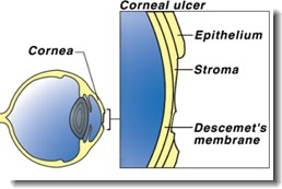 Corneal Ulcers In Dogs